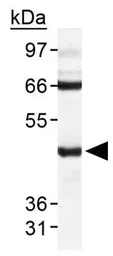 Anti-TDP43 antibody used in Western Blot (WB). GTX48590