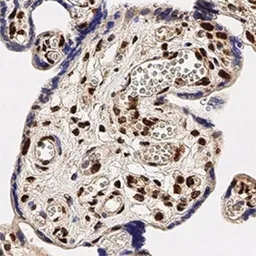 Anti-TDP43 antibody used in IHC (Paraffin sections) (IHC-P). GTX48590