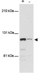 Anti-MTBP antibody [PHL-1] used in Western Blot (WB). GTX48646