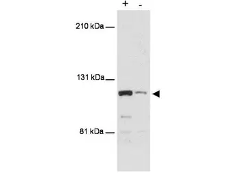 Anti-MTBP antibody [PHL-1] used in Western Blot (WB). GTX48646