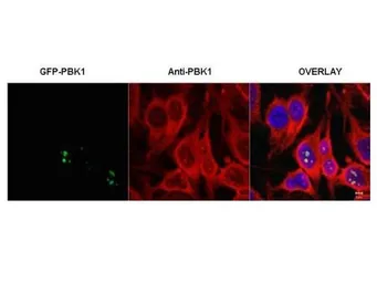 Anti-RSL1D1 antibody used in Immunocytochemistry/ Immunofluorescence (ICC/IF). GTX48683