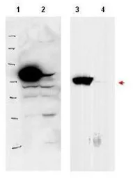 Anti-RSL1D1 antibody used in Western Blot (WB). GTX48683
