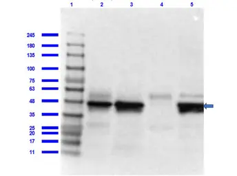 Anti-IL7 Receptor alpha antibody used in Western Blot (WB). GTX48715