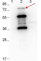 Anti-Borrelia burgdorferi Erpd/Arp37 antibody used in Western Blot (WB). GTX48808