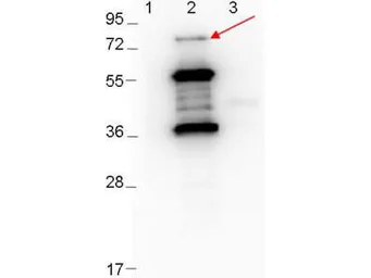 Anti-Borrelia burgdorferi Erpd/Arp37 antibody used in Western Blot (WB). GTX48808