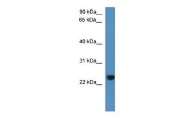 Anti-Capsl antibody, C-term used in Western Blot (WB). GTX48912
