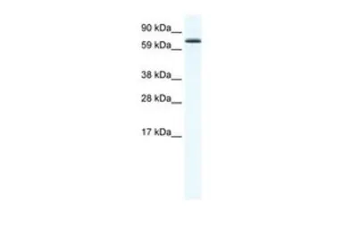 Anti-FOXO6 antibody, N-term used in Western Blot (WB). GTX48993