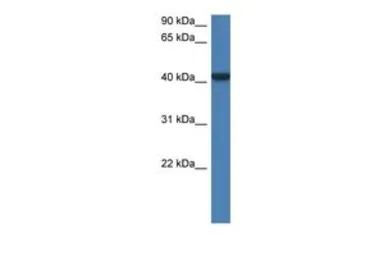 Anti-FGGY antibody, N-term used in Western Blot (WB). GTX49024