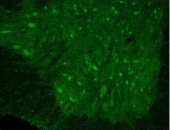 Anti-KCNN2 antibody, C-term used in IHC (Paraffin sections) (IHC-P). GTX49068