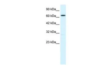 Anti-KCNN2 antibody, C-term used in Western Blot (WB). GTX49068