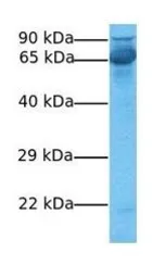 Anti-KCNN2 antibody, C-term used in Western Blot (WB). GTX49068