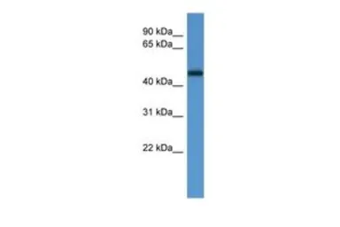 Anti-LCOR antibody, Internal used in Western Blot (WB). GTX49117