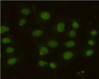 Anti-MSH6 antibody [3E1-B11-F12] used in Immunocytochemistry/ Immunofluorescence (ICC/IF). GTX49251