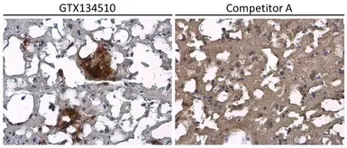 Human Matched Pair Tissue Array - Brain (Alzheimer's Disease + Normal). GTX49382