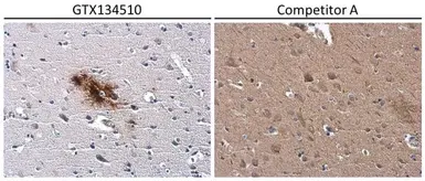 Human Matched Pair Tissue Array - Brain (Alzheimer's Disease + Normal). GTX49382