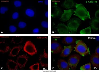 Anti-KCTD15 antibody [AT4C3] used in Immunocytochemistry/ Immunofluorescence (ICC/IF). GTX50002