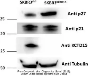 Anti-KCTD15 antibody [AT4C3] used in Western Blot (WB). GTX50002