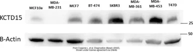 Anti-KCTD15 antibody [AT4C3] used in Western Blot (WB). GTX50002