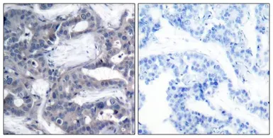 Anti-MEK2 (phospho Thr394) antibody used in IHC (Paraffin sections) (IHC-P). GTX50096