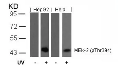 Anti-MEK2 (phospho Thr394) antibody used in Western Blot (WB). GTX50096