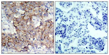 Anti-Her2 / ErbB2 (phospho Tyr877) antibody used in IHC (Paraffin sections) (IHC-P). GTX50142