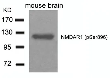 Anti-NMDAR1 (phospho Ser896) antibody used in Western Blot (WB). GTX50168