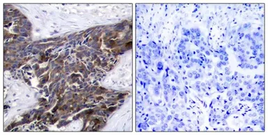 Anti-Connexin 43 (phospho Ser368) antibody used in IHC (Paraffin sections) (IHC-P). GTX50286