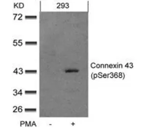 Anti-Connexin 43 (phospho Ser368) antibody used in Western Blot (WB). GTX50286