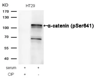 Anti-alpha 1 Catenin (phospho Ser641) antibody used in Western Blot (WB). GTX50338