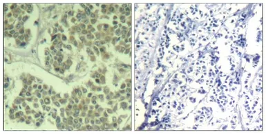 Anti-eIF2 alpha (phospho Ser48) antibody used in IHC (Paraffin sections) (IHC-P). GTX50342