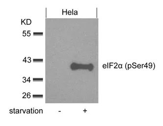 Anti-eIF2 alpha (phospho Ser48) antibody used in Western Blot (WB). GTX50342