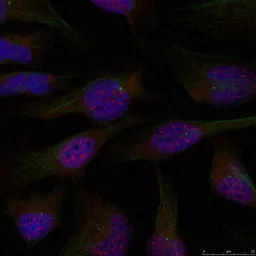 Anti-NFkB p65 antibody used in Immunocytochemistry/ Immunofluorescence (ICC/IF). GTX50371