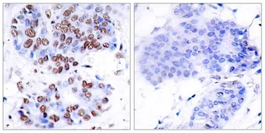 Anti-NFkB p65 antibody used in IHC (Paraffin sections) (IHC-P). GTX50371