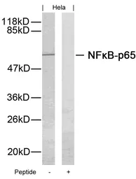 Anti-NFkB p65 antibody used in Western Blot (WB). GTX50371