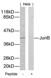 Anti-JunB antibody used in Western Blot (WB). GTX50387