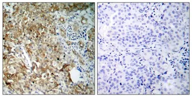 Anti-IGF1R beta antibody used in IHC (Paraffin sections) (IHC-P). GTX50433