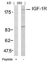 Anti-IGF1R beta antibody used in Western Blot (WB). GTX50433