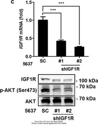 Anti-IGF1R beta antibody used in Western Blot (WB). GTX50433