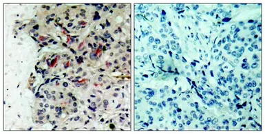 Anti-JAK1 antibody used in IHC (Paraffin sections) (IHC-P). GTX50466