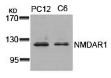 Anti-NMDAR1 antibody used in Western Blot (WB). GTX50477