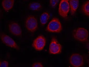 Anti-RPS6 antibody used in Immunocytochemistry/ Immunofluorescence (ICC/IF). GTX50552