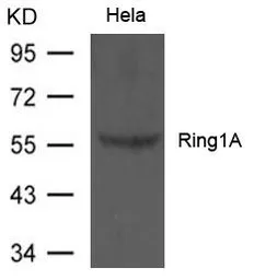Anti-Ring1A antibody used in Western Blot (WB). GTX50803