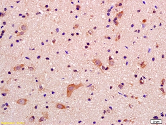 Anti-GRID2IP antibody used in IHC (Paraffin sections) (IHC-P). GTX51075