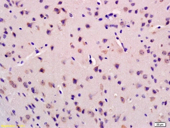 Anti-GRID2IP antibody used in IHC (Paraffin sections) (IHC-P). GTX51075