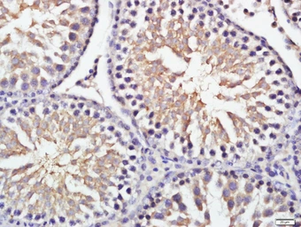 Anti-GRINA antibody used in IHC (Paraffin sections) (IHC-P). GTX51232