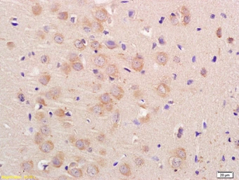 Anti-UNC80 antibody used in IHC (Paraffin sections) (IHC-P). GTX51241