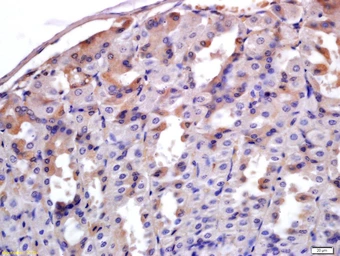 Anti-ADAM28 antibody used in IHC (Paraffin sections) (IHC-P). GTX51662