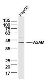 Anti-CLMP antibody used in Western Blot (WB). GTX51678