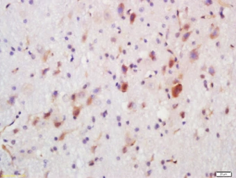 Anti-FUT8 antibody used in IHC (Paraffin sections) (IHC-P). GTX51712