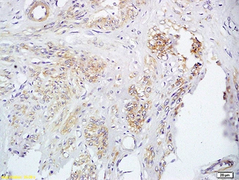 Anti-FUT8 antibody used in IHC (Paraffin sections) (IHC-P). GTX51712